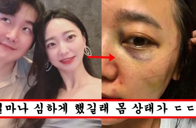 결혼과 이혼사이 서사랑 바람피다가 남편한테 폭행당했다는데..