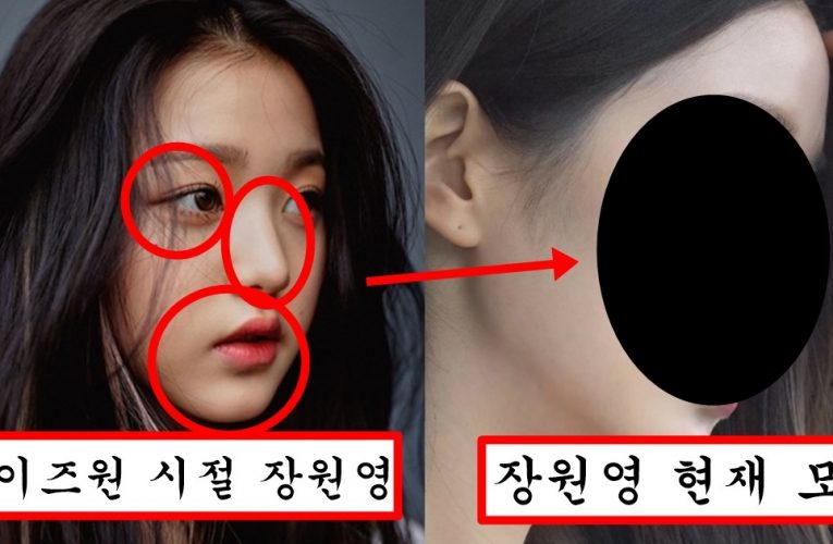 성형논란 가장 많은 아이돌 장원영이 진짜 성형했는지 하나하나 뜯어서 알아보자