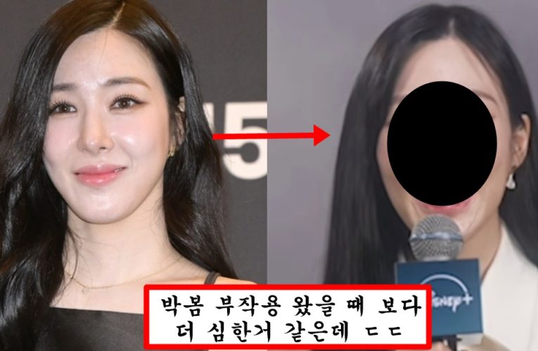 성형 너무 많이 해서 부작용 왔는지 그냥 충격 그 자체라는 티파니 최근 얼굴 근황