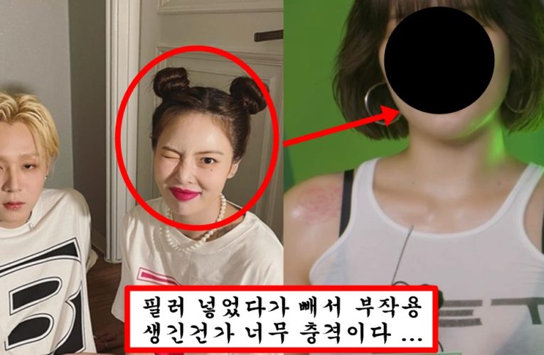 입술 필러 뺏다가 그냥 할머니 되어버렸다는 현아 충격 근황